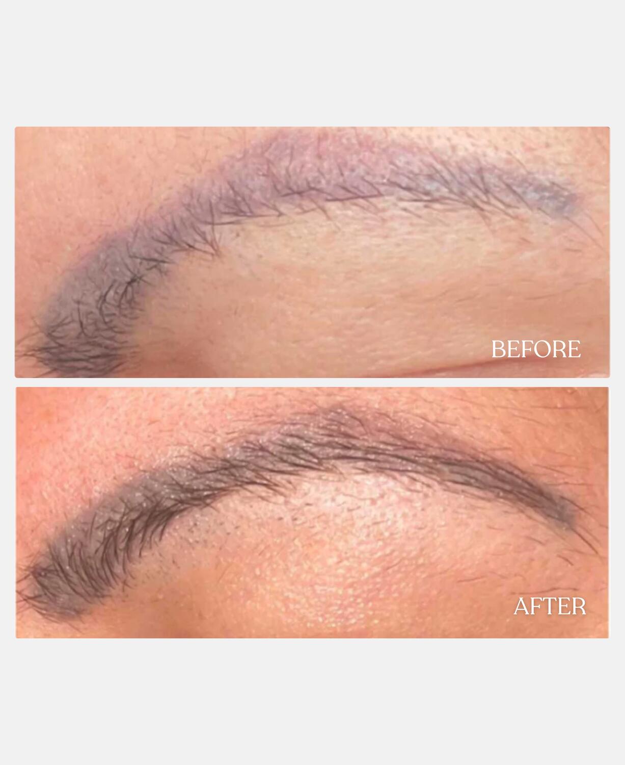 Øjenbryn serum - 3 ml